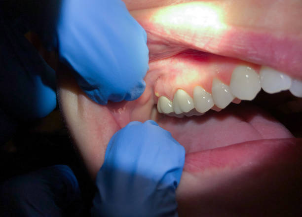 Best Emergency Treatment for Jaw Pain or Injury in Mountain Village, CO