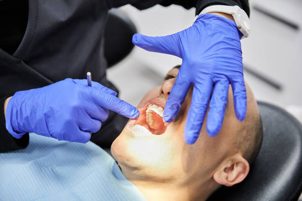 Best Emergency Treatment for Jaw Pain or Injury in Mountain Village, CO